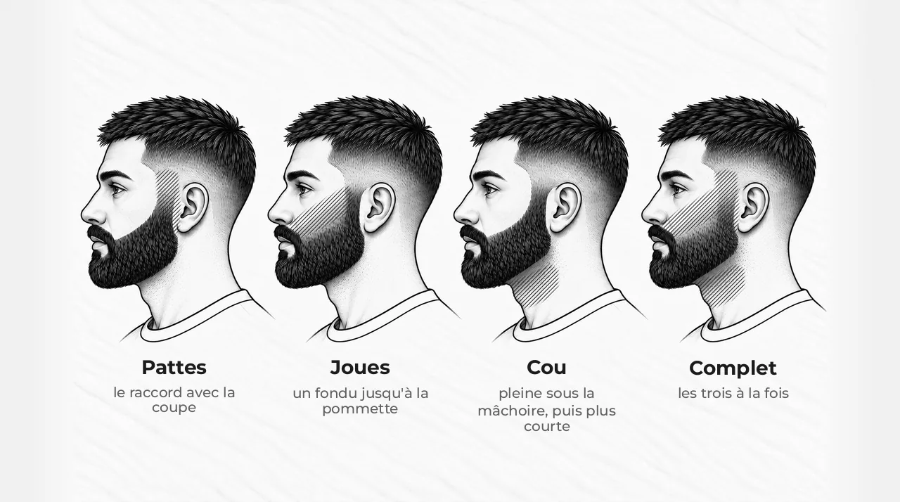 Schéma de quatre têtes d'homme de profil avec la même barbe, la zone dégradée hachurée : seulement à la patte, seulement sur la joue, seulement sur le cou, puis partout